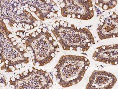 Immunohistochemistry-Paraffin: RGS6 Antibody [NBP3-06581] - Staining of human RGS6 in human small intestine with rabbit polyclonal antibody at 1:1000 dilution.