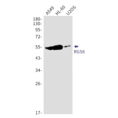 Western Blot: RGS6 Antibody (S02-1D3) [NBP3-19913] - Western blot detection of RGS6 in A549, HL-60, U2OS cell lysates using NBP3-19913 (1:1000 diluted). Predicted band size: 54kDa. Observed band size: 54kDa.