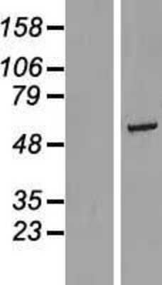 Western Blot: RGS6 Overexpression Lysate (Adult Normal) [NBL1-15336] Left-Empty vector transfected control cell lysate (HEK293 cell lysate); Right -Over-expression Lysate for RGS6.