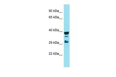 Western Blot: RGS7BP Antibody [NBP2-83444] - Host: Rabbit. Target Name: RGS7BP. Sample Type: MCF7 Whole Cell lysates. Antibody Dilution: 1.0ug/ml