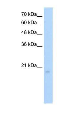 Western Blot: RGS8 Antibody [NBP1-80510] - HepG2 cell lysate, concentration 5.0ug/ml.