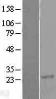 Western Blot RGS8 Overexpression Lysate