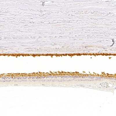 Immunohistochemistry-Paraffin: RGS9 Antibody [NBP2-58294] - Staining of human retina shows strong cytoplasmic positivity in photoreceptor segments.