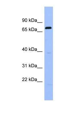 Western Blot: RGS9 Antibody [NBP1-58909] - Titration: 0.2-1 ug/ml, Positive Control: Human Spleen.