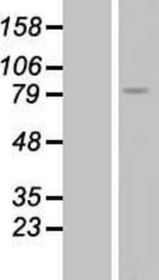 Western Blot: RGS9 Overexpression Lysate (Adult Normal) [NBL1-15339] Left-Empty vector transfected control cell lysate (HEK293 cell lysate); Right -Over-expression Lysate for RGS9.