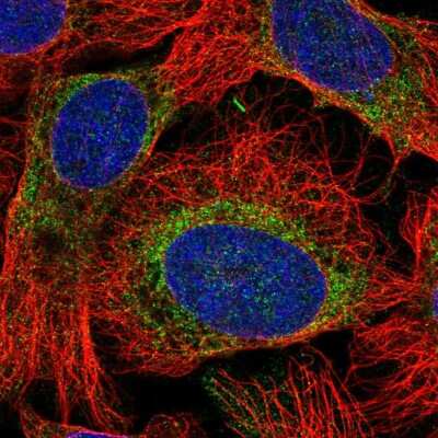 Immunocytochemistry/Immunofluorescence: RHBDD1 Antibody [NBP2-55395] - Staining of human cell line U-2 OS shows localization to endoplasmic reticulum.