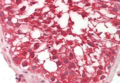 Immunohistochemistry-Paraffin: RHBDD1 Antibody [NBP2-88151] - Rabbit Anti-RHBDD1 antibody. Formalin Fixed Paraffin Embedded Tissue: Human Testis. Primary antibody Concentration: 1:100. Secondary Antibody: Donkey anti-Rabbit-Cy3. Secondary Antibody Concentration: 1:200. Magnification: 20x. Exposure Time: 0.5-2.0 sec