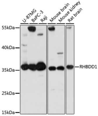 Western Blot RHBDD1 Antibody - Azide and BSA Free