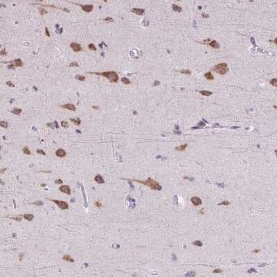 Immunohistochemistry: RHBDD2 Antibody [NBP2-47305] - Staining of human cerebral cortex shows strong cytoplasmic positivity in neuronal cells.