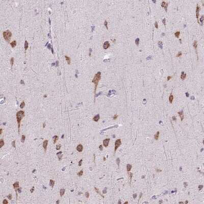 Immunohistochemistry-Paraffin: RHBDD2 Antibody [NBP2-47305] - Staining of human cerebral cortex shows moderate  granular cytoplasmic positivity in neurons.