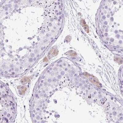 Immunohistochemistry-Paraffin: RHBDD2 Antibody [NBP2-47305] - Staining of human testis shows weak cytoplasmic positivity in Leydig cells.