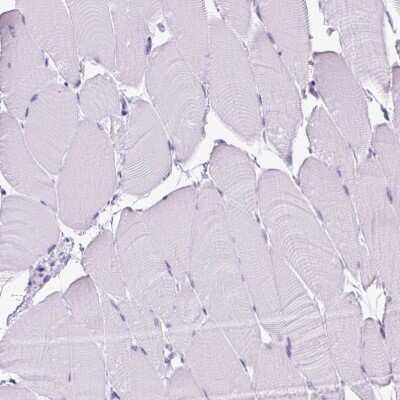 Immunohistochemistry-Paraffin: RHBDD2 Antibody [NBP2-47305] - Staining of human skeletal muscle shows no positivity in myocytes as expected.