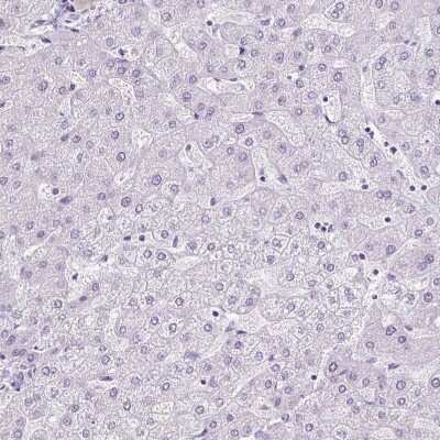 Immunohistochemistry-Paraffin: RHBDD2 Antibody [NBP2-47305] - Staining of human liver shows no positivity in hepatocytes as expected.