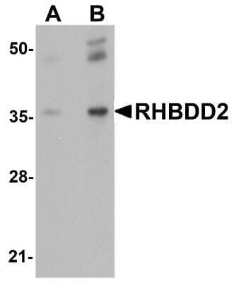 Western Blot RHBDD2 Antibody - BSA Free