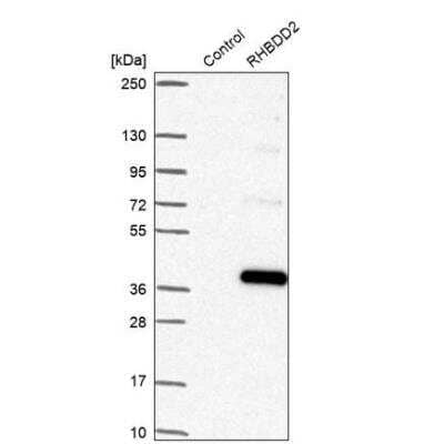Western Blot RHBDD2 Antibody - BSA Free