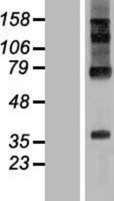 Western Blot: RHBDD2 Overexpression Lysate (Adult Normal) [NBL1-15341] Left-Empty vector transfected control cell lysate (HEK293 cell lysate); Right -Over-expression Lysate for RHBDD2.