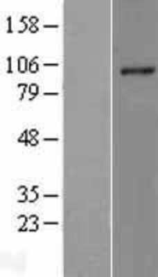 Western Blot: RHBDF2 Overexpression Lysate (Adult Normal) [NBL1-15344] Left-Empty vector transfected control cell lysate (HEK293 cell lysate); Right -Over-expression Lysate for RHBDF2.