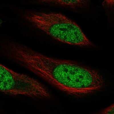 Immunocytochemistry/Immunofluorescence: RHBDL1 Antibody [NBP2-57513] - Staining of human cell line U-2 OS shows localization to nucleoplasm.