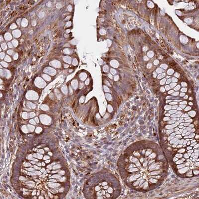 Immunohistochemistry-Paraffin: RHBDL1 Antibody [NBP2-13229] Staining of human colon shows strong cytoplasmic positivity in glandular cells.