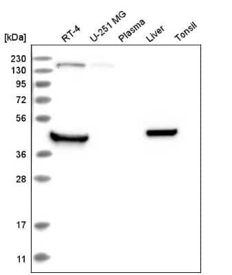 Western Blot: RHBDL1 Antibody [NBP2-57512] - Western blot analysis in human cell line RT-4, human cell line U-251 MG, human plasma, human liver tissue and human tonsil tissue.