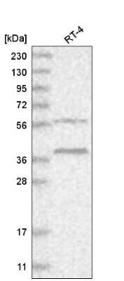 Western Blot: RHBDL1 Antibody [NBP2-57513] - Western blot analysis in human cell line RT-4.