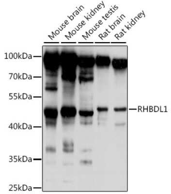 Western Blot: RHBDL1 Antibody [NBP2-93706] - Analysis of extracts of various cell lines, using RHBDL1 at 1:1000 dilution. Secondary antibody: HRP Goat Anti-Rabbit IgG (H+L) at 1:10000 dilution. Lysates/proteins: 25ug per lane. Blocking buffer: 3% nonfat dry milk in TBST. Detection: ECL Basic Kit . Exposure time: 10s.