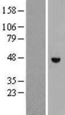 Western Blot: RHBDL1 Overexpression Lysate (Adult Normal) [NBP2-07931] Left-Empty vector transfected control cell lysate (HEK293 cell lysate); Right -Over-expression Lysate for RHBDL1.