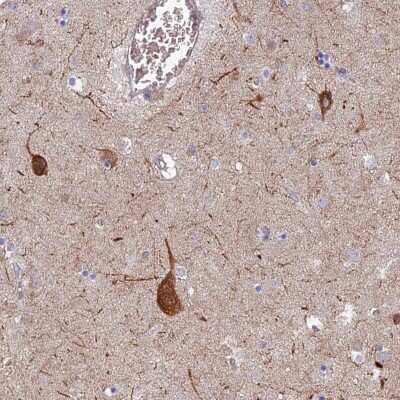 Immunohistochemistry-Paraffin RHBDL2 Antibody - BSA Free