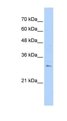 Western Blot RHBDL2 Antibody - BSA Free