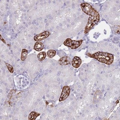 Immunohistochemistry-Paraffin: RHBG Antibody [NBP2-33527] - Staining of human kidney shows strong cytoplasmic and membranous positivity in tubule cells.