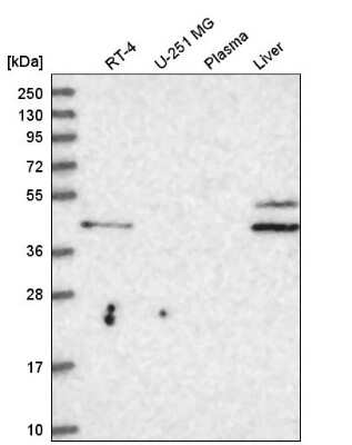 Western Blot: RHBG Antibody [NBP2-59022] - Western blot analysis in human cell line RT-4, human cell line U-251 MG, human plasma and human liver tissue.