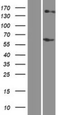 Western Blot: RHCE Overexpression Lysate (Adult Normal) [NBP2-05615] Left-Empty vector transfected control cell lysate (HEK293 cell lysate); Right -Over-expression Lysate for RHCE.