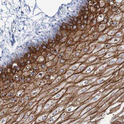 Immunohistochemistry: RHCG Antibody [NBP2-30825] - Staining of human oral mucosa shows strong membranous and cytoplasmic positivity in superficial squamous epithelial cells.