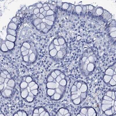 Immunohistochemistry-Paraffin: RHCG Antibody [NBP2-30825] - Staining of human rectum shows low expression as expected.