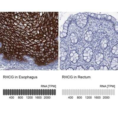 <b>Orthogonal Strategies Validation. </b>Immunohistochemistry-Paraffin: RHCG Antibody [NBP2-30825] - Staining in human esophagus and rectum tissues using anti-RHCG antibody. Corresponding RHCG RNA-seq data are presented for the same tissues.