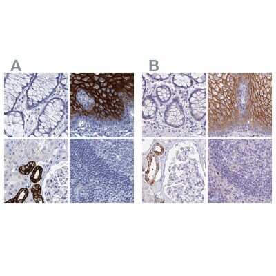 <b>Independent Antibodies Validation. </b>Immunohistochemistry-Paraffin: RHCG Antibody [NBP2-30825] - Staining of human colon, esophagus, kidney and lymph node using Anti-RHCG antibody NBP2-30825 (A) shows similar protein distribution across tissues to independent antibody NBP2-30905 (B).