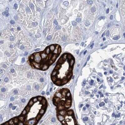 Immunohistochemistry-Paraffin: RHCG Antibody [NBP2-30825] - Staining of human kidney.