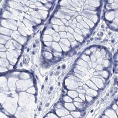 Immunohistochemistry-Paraffin: RHCG Antibody [NBP2-30825] - Staining of human colon.