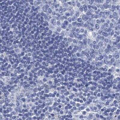 Immunohistochemistry-Paraffin: RHCG Antibody [NBP2-30825] - Staining of human lymph node.