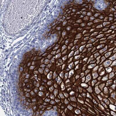 Immunohistochemistry-Paraffin: RHCG Antibody [NBP2-30825] - Staining of human Esophagus shows strong membranous positivity in squamous epithelial cells.