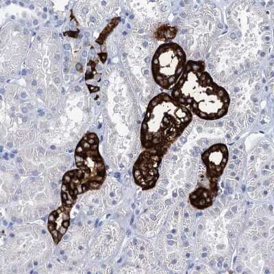 Immunohistochemistry-Paraffin: RHCG Antibody [NBP2-30825] - Staining of human kidney shows strong membranous positivity in cells in distal tubules.