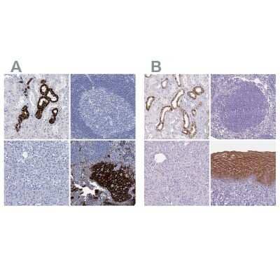 Immunohistochemistry-Paraffin: RHCG Antibody [NBP2-30825] - Staining of human kidney, lymph node, pancreas and squamous epithelia using Anti-RHCG antibody NBP2-30825 (A) shows similar protein distribution across tissues to independent antibody NBP2-30905 (B).