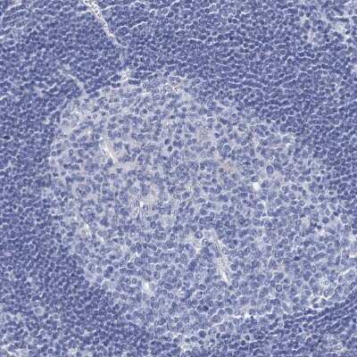 Immunohistochemistry-Paraffin: RHCG Antibody [NBP2-30825] - Staining of human Lymph node shows no membranous positivity in non-germinal center cells as expected.