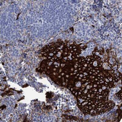 Immunohistochemistry-Paraffin: RHCG Antibody [NBP2-30825] - Staining of human Tonsil shows strong membranous positivity in squamous epithelial cells.