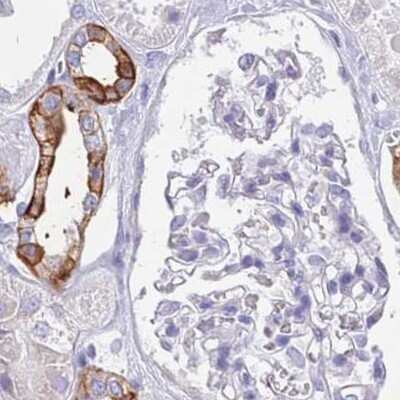 Immunohistochemistry-Paraffin: RHCG Antibody [NBP2-30905] - Staining of human kidney.