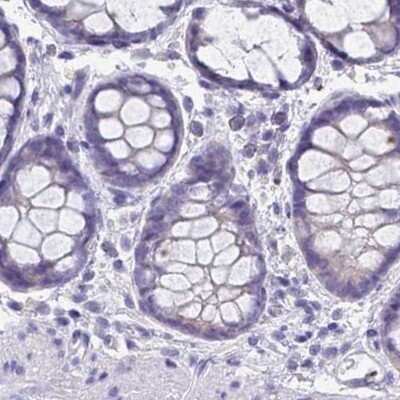 Immunohistochemistry-Paraffin: RHCG Antibody [NBP2-30905] - Staining of human colon.