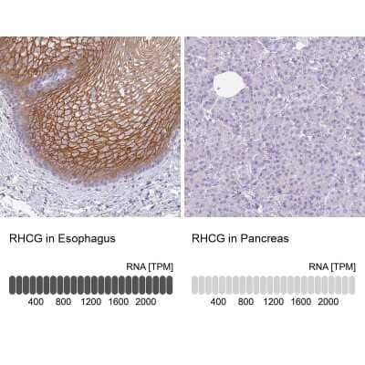 Immunohistochemistry-Paraffin: RHCG Antibody [NBP2-30905] - Analysis in human esophagus and pancreas tissues using NBP2-30905 antibody. Corresponding RHCG RNA-seq data are presented for the same tissues.