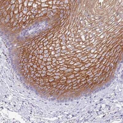 Immunohistochemistry-Paraffin: RHCG Antibody [NBP2-30905] - Staining of human Esophagus shows strong membranous positivity in squamous epithelial cells.