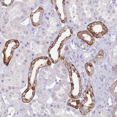 Immunohistochemistry-Paraffin: RHCG Antibody [NBP2-30905] - Staining of human kidney shows strong membranous positivity in cells in distal tubules.