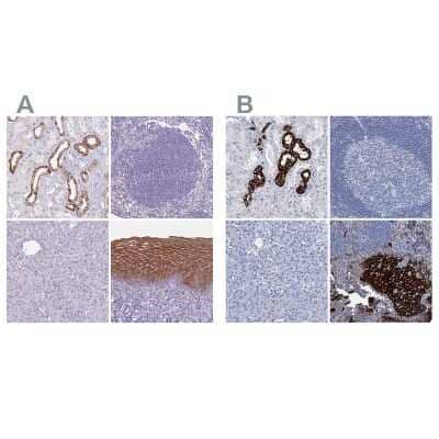 Immunohistochemistry-Paraffin: RHCG Antibody [NBP2-30905] - Staining of human kidney, lymph node, pancreas and squamous epithelia using Anti-RHCG antibody NBP2-30905 (A) shows similar protein distribution across tissues to independent antibody NBP2-30825 (B).